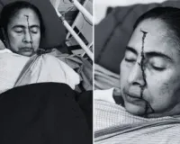 दुर्घटना में पश्चिम बंगाल की सीएम ममता बनर्जी घायल...सिर पर लगी चोट